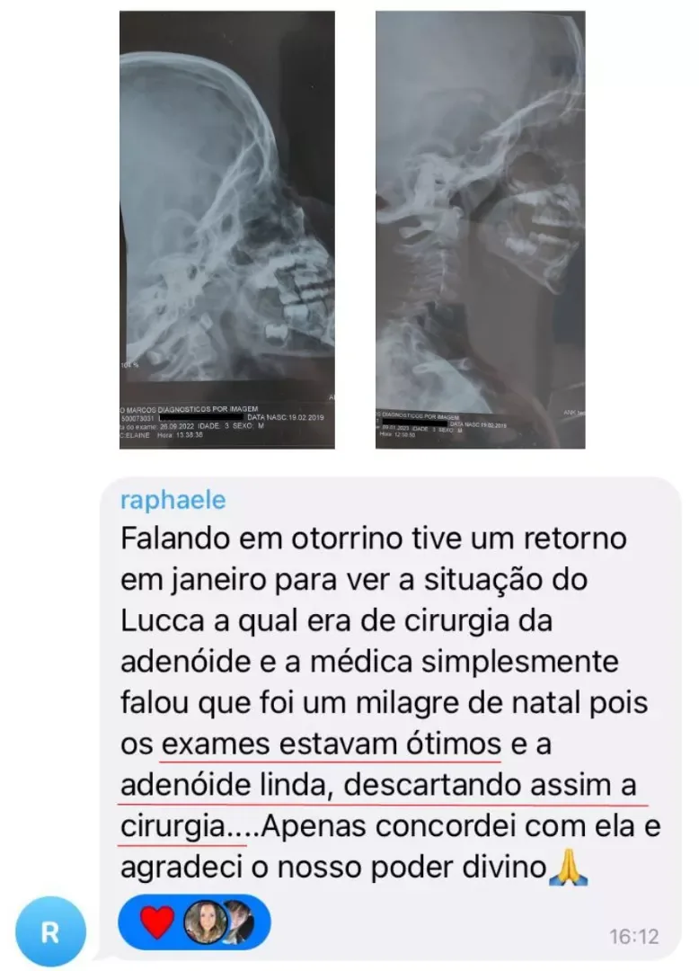 Print do depoimento da Rafaele sobre a cirurgia descartada